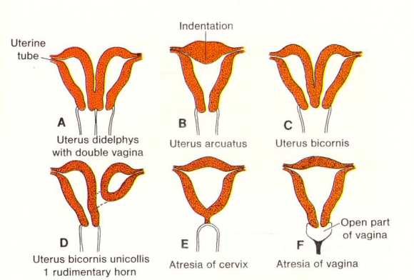 Utero bicorne: si può rimanere incinta?