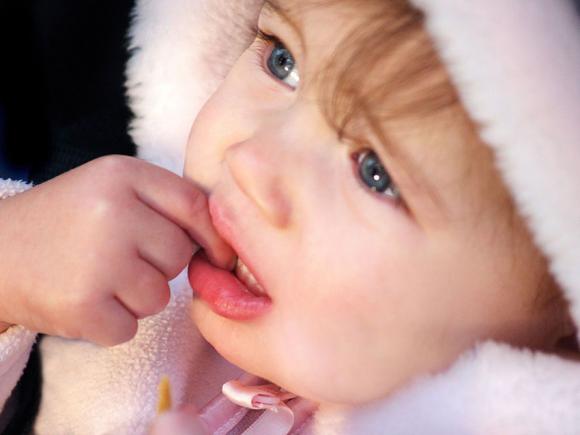 La stomatite nei bambini può contagiare il resto del corpo